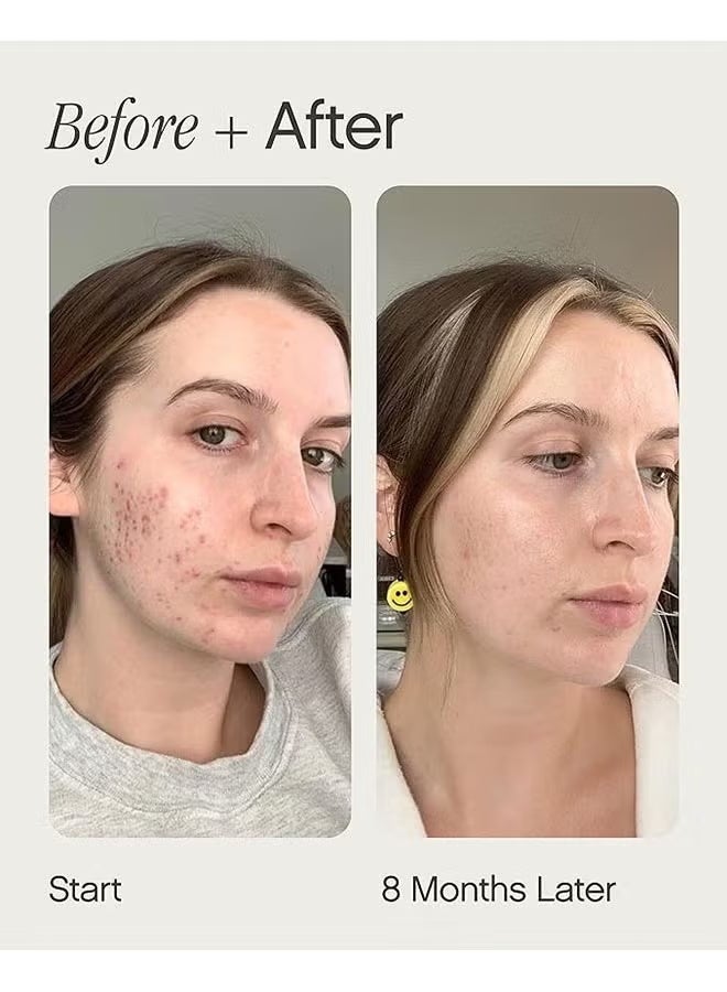 TOPICALS Brightening and Clearing Serum 50ml, Faded Serum for Dark Spots and Discoloration Hyperpigmentation, Postblemish Marks Scars And Spots, Mini Faded Serum for Uneven Skin Tone - Image 3