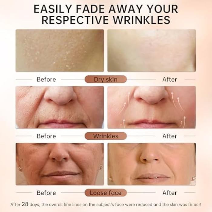 VGO Retinol Serum for Face, Resurfacing Retinol Serum with Hyaluronic Acid, Niacinamide and Ceramides, Hydrating and Refreshing, Wrinkle Smoothing, Suitable for Sensitive Skin (1 pack) - Image 4