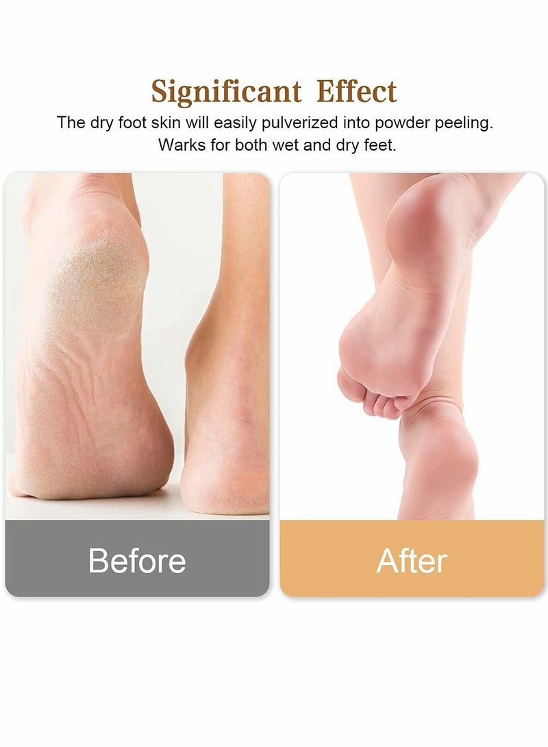 Glass Foot File Callus Remover, Innovative Nano Crystal Feet Scrubber for Travel Use, Portable Pedicure Foot Scraper for Cracked Heel (Normal)
