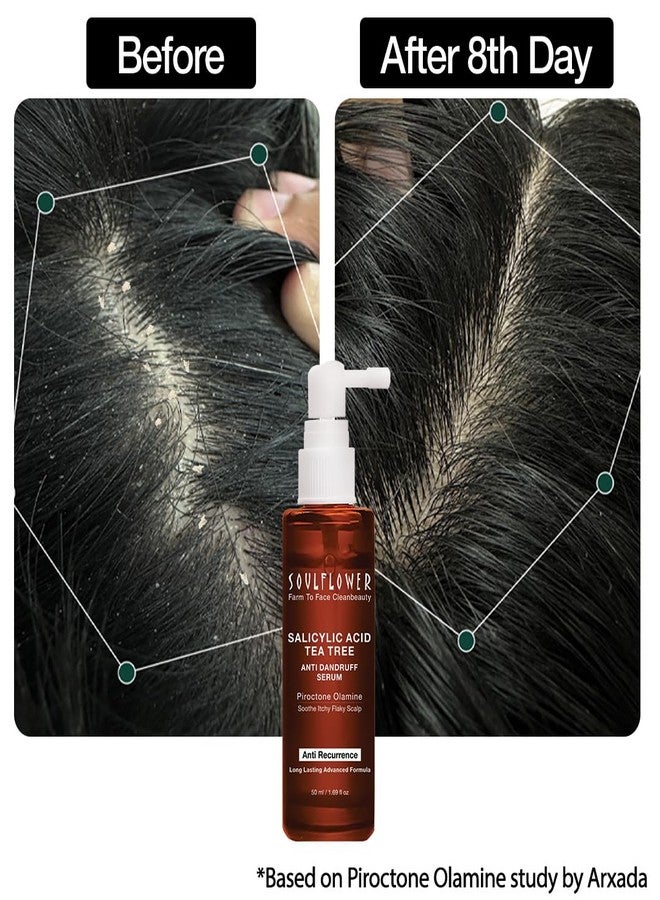 Soulflower Anti Dandruff Hair Serum with Piroctone Olamine, 2% Salicylic Acid & Rosemary Essential Oil for Hair Growth, Anti Hair Fall, Frizz Control Lotion for Men & Women for All Hair Types | 50ml - Image 3