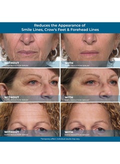 Plexaderm Plexaderm Rapid Reduction Eye Serum - Advanced Formula Anti Aging Visibly Reduces Under-Eye Bags, Wrinkles, Dark Circles, Fine Lines & Crow's Feet Instantly Instant Wrinkle Remover for Face  - Image 5
