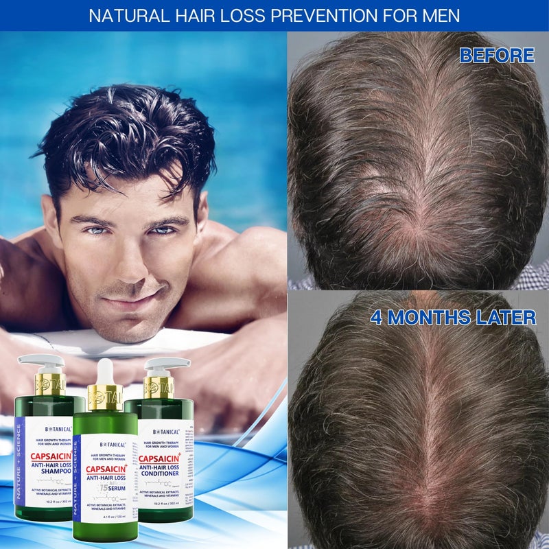 BOTANICAL HAIR GROWTH LAB Botanical Capsaicin Shampoo for Hair Loss and Hair Thinning Oil-Free Scalp Stimulating Natural Shampoo For Men & Women 10.2 Fl Oz - Image 3