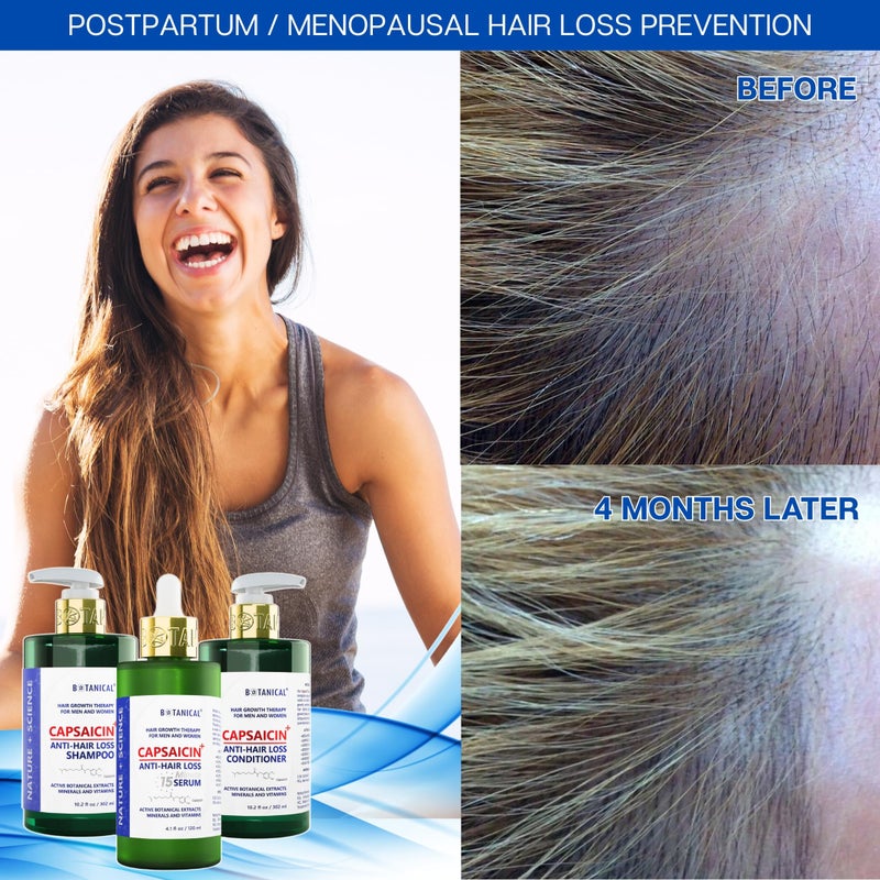 BOTANICAL HAIR GROWTH LAB Botanical Capsaicin Shampoo for Hair Loss and Hair Thinning Oil-Free Scalp Stimulating Natural Shampoo For Men & Women 10.2 Fl Oz - Image 4