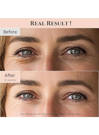 Revive Eye Serum with Retinal Niacinamide Peptide Correction for Puffy Eye Bags Fine Lines Dark Circles Wrinkles, Korean Skin Care 30ml, 1 fl.oz 30ml - view 3