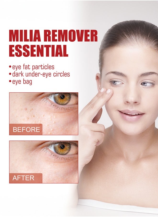 SOUTH MOON - Eye Essence Eye Repair Cream Under Eye Cream For Puffiness And Bags Under Eyes Hydrating Eye Cream Opthalmologist Tested - Image 1