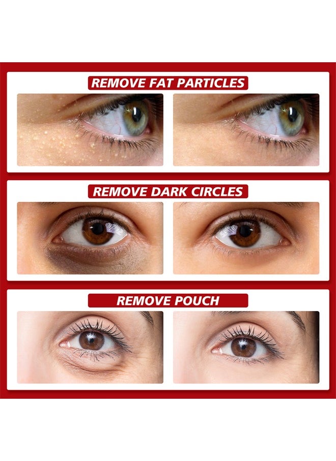 SOUTH MOON - Eye Essence Eye Repair Cream Under Eye Cream For Puffiness And Bags Under Eyes Hydrating Eye Cream Opthalmologist Tested - Image 1