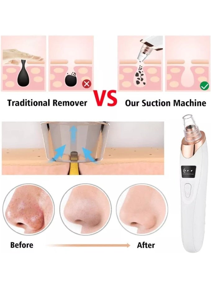 كيمايا جهاز كهربائي لإزالة الرؤوس السوداء، جهاز تنظيف حب الشباب، إزالة البقع السوداء، جهاز تنظيف عميق للوجه، جهاز تنظيف المسام، أدوات العناية بالبشرة - Image 3