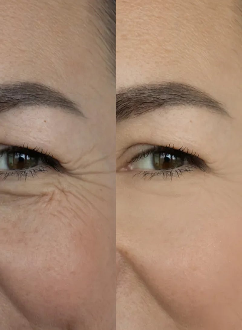 يسما مجموعة من 2 سيروم تجميل الوجه - زيت الأفوكادو وخلاصة التوت الأزرق، يزيل حب الشباب والبثور، يقلل من الخطوط الدقيقة والتجاعيد، لجميع أنواع البشرة 10 مل - Image 4