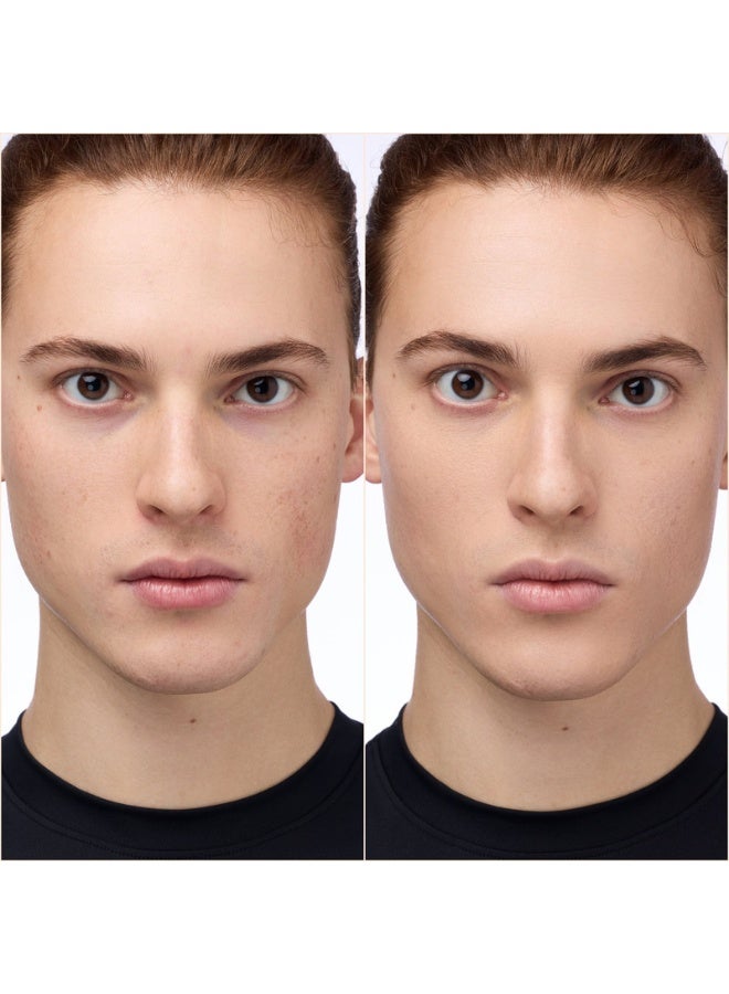 Catrice سيروم كونسيلر مضيء فوري 032N - Image 5