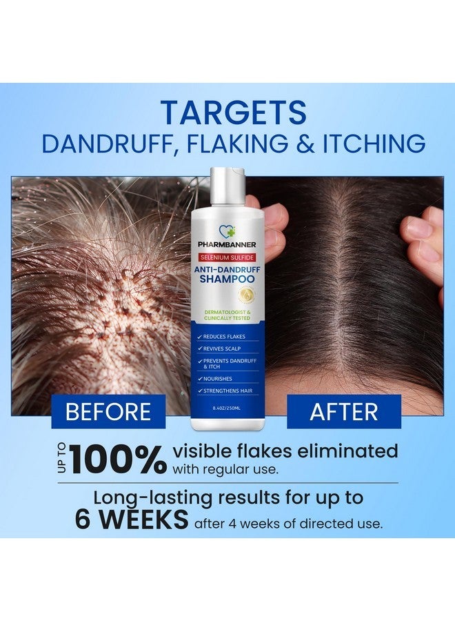 PHARMBANNER Anti-Dandruff Shampoo with Selenium Sulfide: For Flaky Scalp, Itching & Seborrheic Dermatitis Relief - Menthol & Lavender Oil - Moisturizing, Color Safe, Gentle for All Hair Types - 8.4oz - Image 2