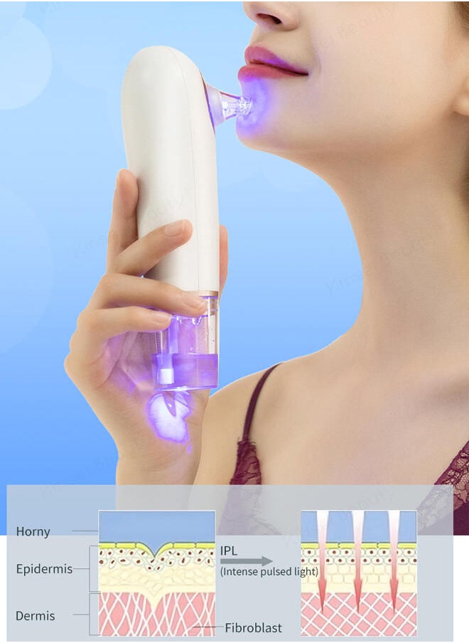 4-in-1 Upgraded Facial Pore Blackhead Remover Vacuum Cleaning Instrument Gold - https://f.nooncdn.com/p/pzsku/Z641F33B0E5FF93B2709CZ/45/_/1673055338/30013612-8c8c-48fe-9f4e-afe8ba236d78.jpg?format=jpg&width=original