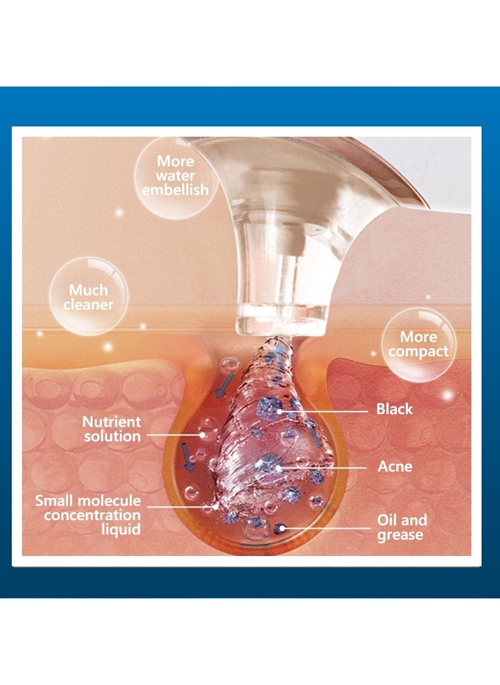 4-in-1 Upgraded Facial Pore Blackhead Remover Vacuum Cleaning Instrument Gold - https://f.nooncdn.com/p/pzsku/Z641F33B0E5FF93B2709CZ/45/_/1673055339/4e701233-0ead-4a4b-8c03-c015de8fe6d2.jpg?width=original
