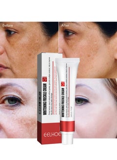 Whitening Freckle Cream,Pigmentation Removal Cream for Face,Freckle Remover Cream,Moisturizing Anti-blemish Cream,Dark Spots Remover Skin Whitening (Freckle Cream)