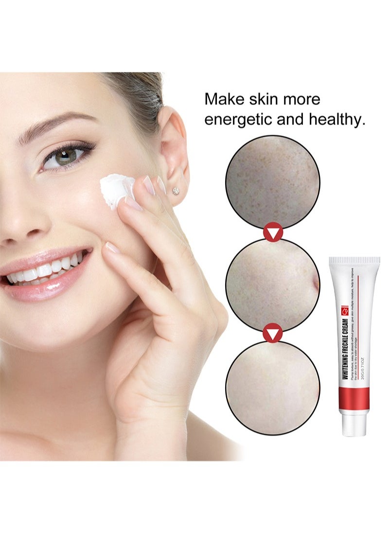 EELHOE - Whitening Freckle Cream,Pigmentation Removal Cream for Face,Freckle Remover Cream,Moisturizing Anti-blemish Cream,Dark Spots Remover Skin Whitening (Freckle Cream) - Image 1