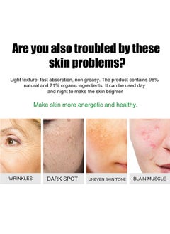EELHOE Whitening Freckle Cream,Pigmentation Removal Cream for Face,Freckle Remover Cream,Moisturizing Anti-blemish Cream,Dark Spots Remover Skin Whitening (Freckle Cream)  - Image 2