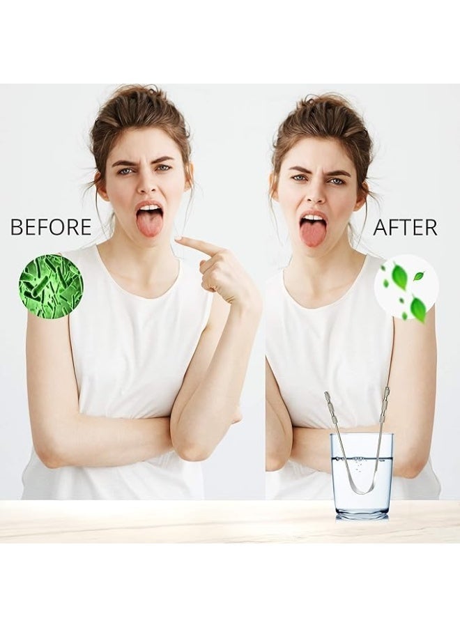 أداة كشط للعناية باللسان للبالغين من فولاذ مقاوم للصدأ بنسبة 100% - أفضل منظف لسان معدني لتحسين نظافة الفم، عبوة من قطعتين - Image 5