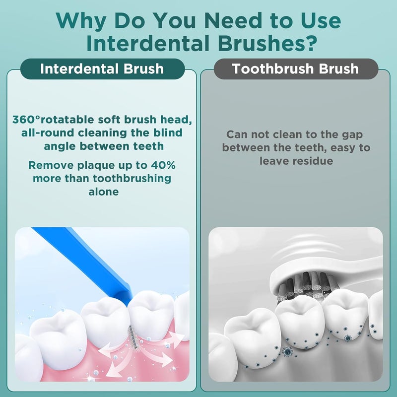 Fremouth 50 Count Angle Interdental Brushes for Braces Tight07mm L Shaped Interproximal Floss for Dental Plaque Removal Health - Image 5