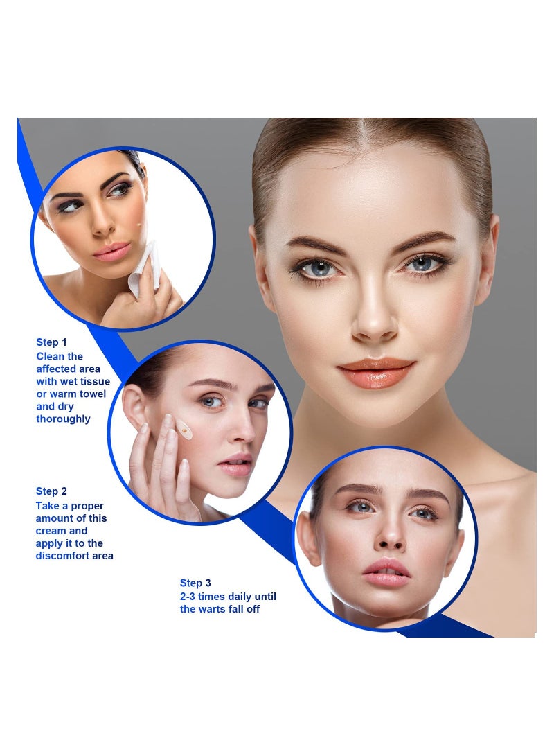 سوميفون كريم مرهم لإزالة الثآليل ، ثؤلول شائع لإزالة علامات بشرة الجسم ومزيل علامات بشرة الوجه 2 عبوة - Image 5