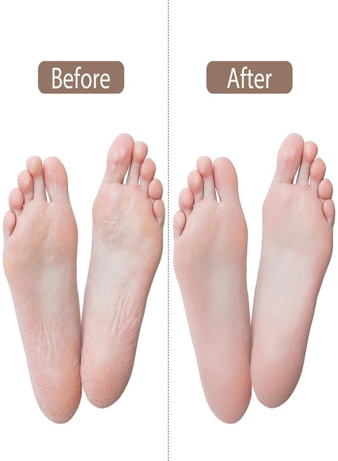 Tbestmax جوارب سيليكون جل Tbestmax 12 قطعة لقدمين جافتين ومتشققتين للنساء - جوارب نهارية وليلية - W4-10 | M5-8 - Image 2
