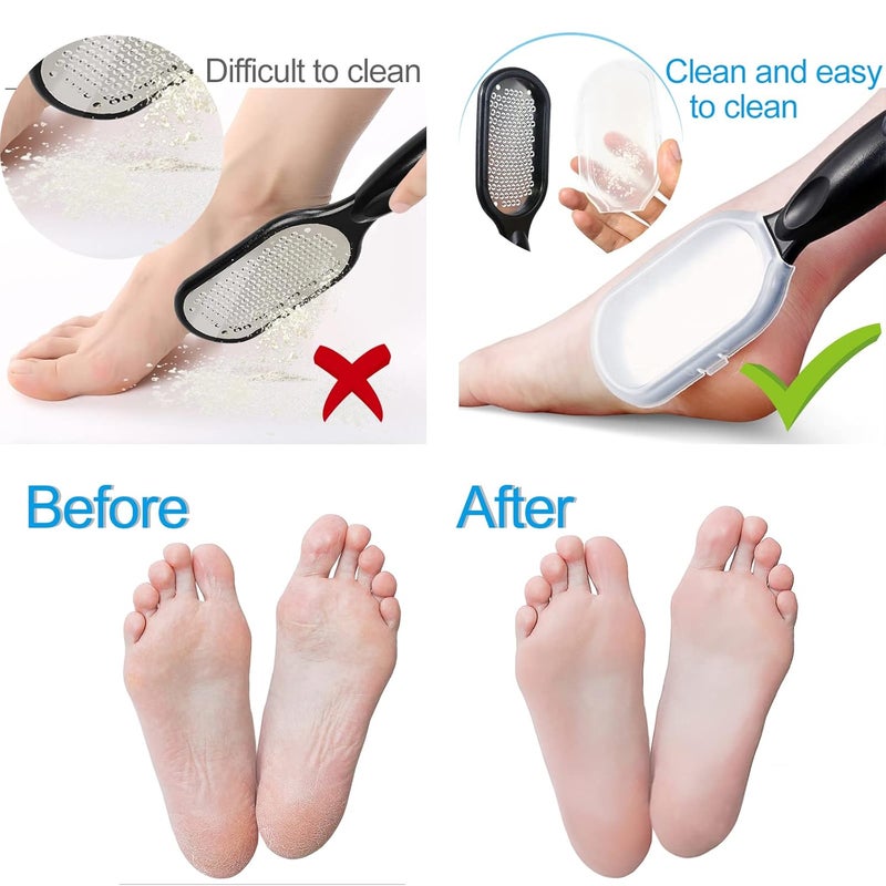 Sularpek Foot File Foot Scraper Best Foot Care Pedicure Metal Surface Tool to Remove Hard Skin Can Be Used on Both Wet and Dry Feet Surgical Grade Stainless Steel File - Image 4