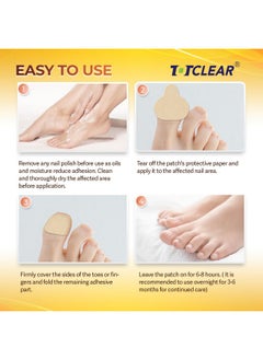 Fungal Nail Patches: Nail Fungus Relief Toenail Fungus Relief Nighttime Renewal Fungal Nail Patches Nail Fungus Improvement Overnight Nail Repair 8Hour Nighttime Renewal 21 Pcs - pzsku/Z64602ACF4A570594E0C2Z/45/_/1721027091/b261fef6-9026-4087-8c4c-5ad4a0c136c1