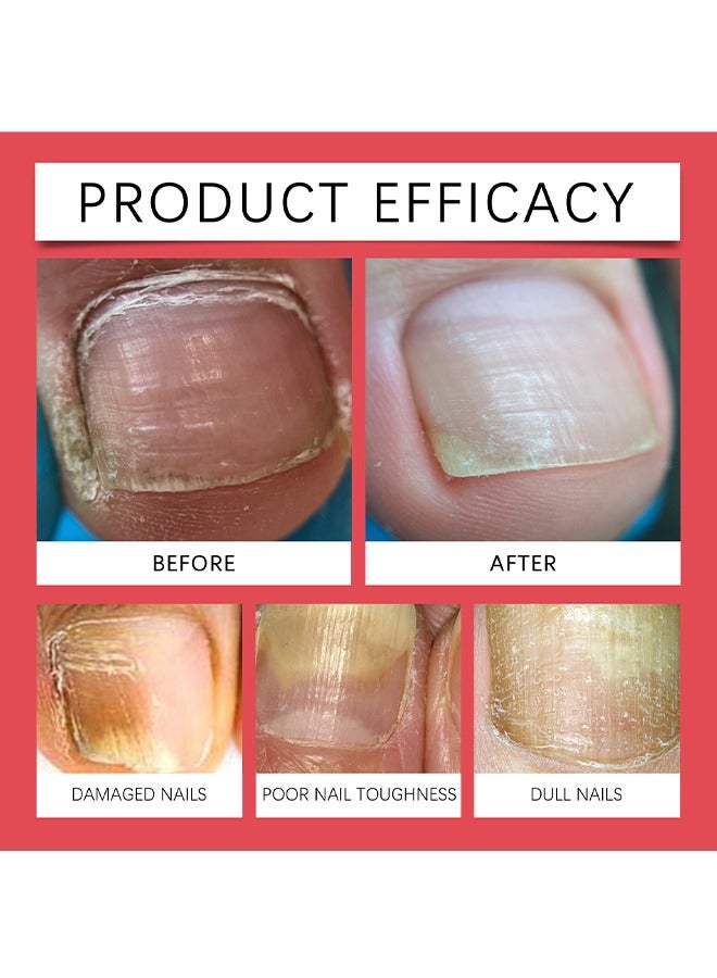  اوساورا قلم زيت البشرة - 4 أقلام زيت البشرة - قلم مقوي الأظافر ونمو زيت الأظافر مع زيت اللوز الحلو، وزيت الجوجوبا للعناية بالأظافر، وزيت فيتامين E - قلم زيت نمو الأظافر (12 مل - 3 مل * 4) - Image 5