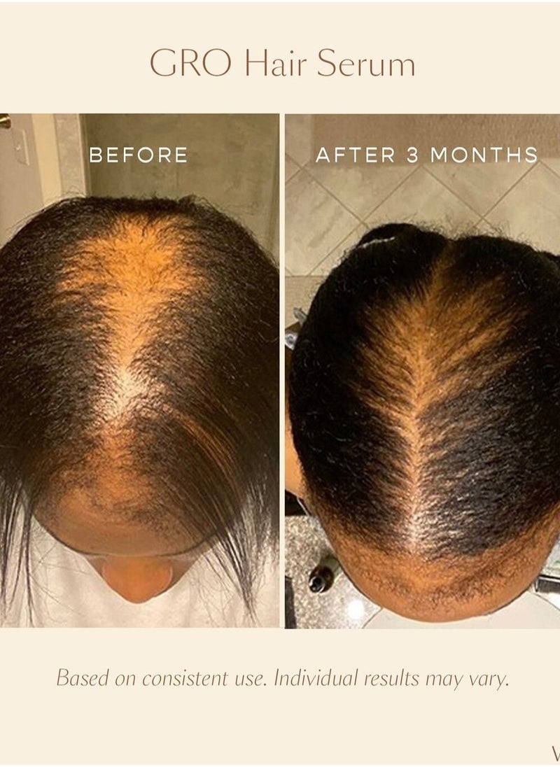 VEGAMOUR - "VEGAMOUR GRO Hair Serum (30ml) - Plant-Based Serum for Thinning Hair, Promotes Thicker, Fuller, and Healthier-Looking Hair, Vegan & Cruelty-Free" - Image 1