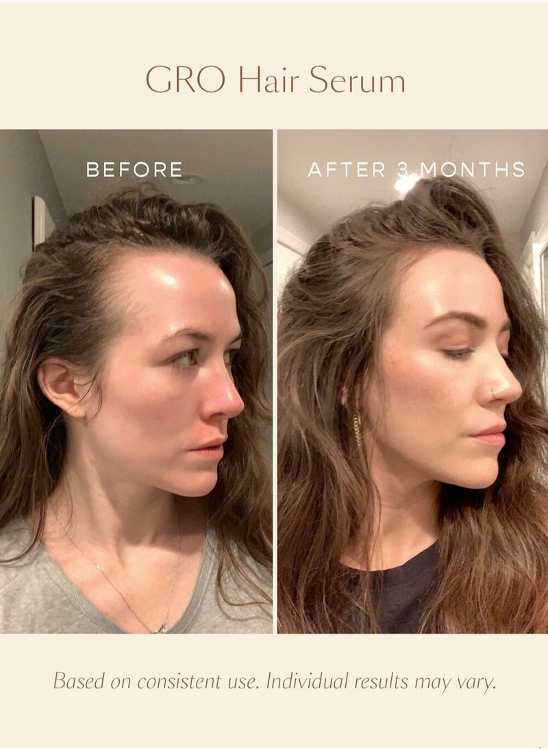 VEGAMOUR - "VEGAMOUR GRO Hair Serum (30ml) - Plant-Based Serum for Thinning Hair, Promotes Thicker, Fuller, and Healthier-Looking Hair, Vegan & Cruelty-Free" - Image 1
