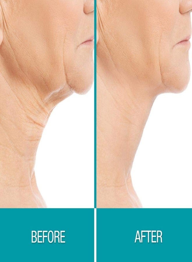 Dermactin ديرماكتين-تي إس كريم بي غون لوسيون للجسم 3 أونصات (عبوة 2) - Image 3