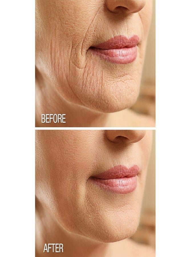 Dermactin ديرماكتين-تي إس كريم بي غون لوسيون للجسم 3 أونصات (عبوة 2) - Image 5