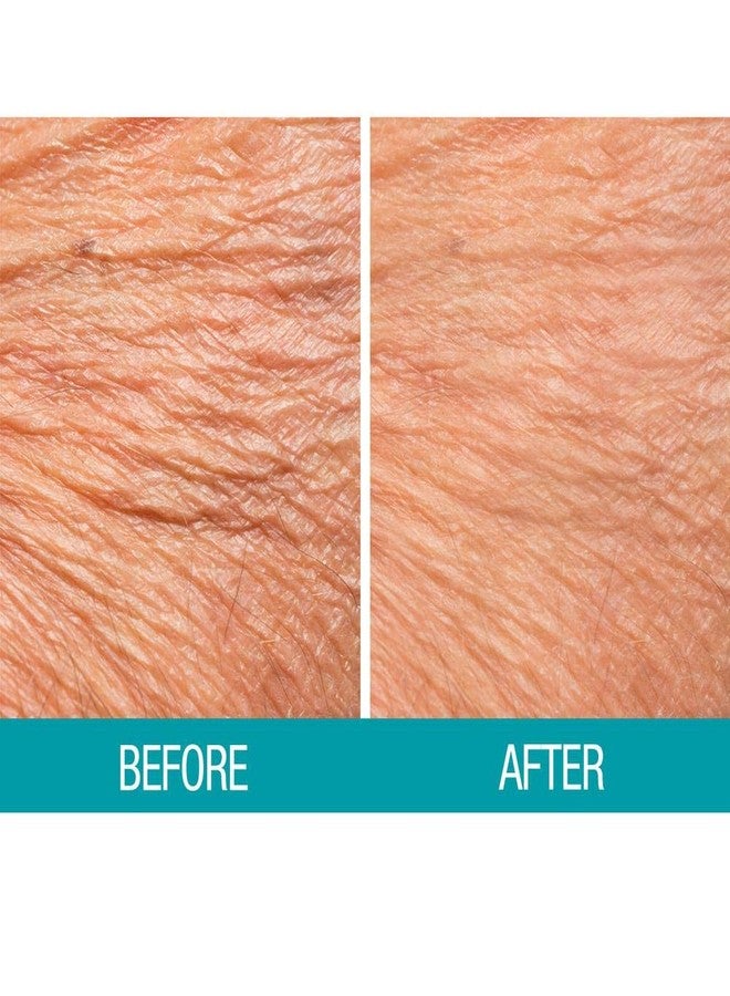 Dermactin ديرماكتين-تي إس كريم بي غون لوسيون للجسم 3 أونصات (عبوة 2) - Image 4