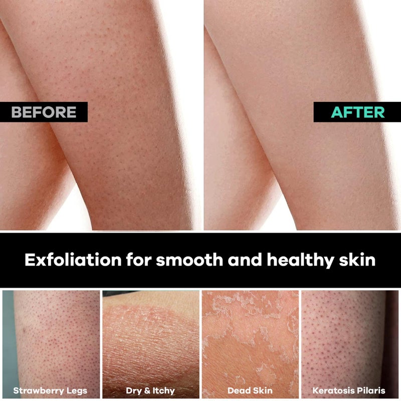 Dermasuri Deep Exfoliating Glove for Shower - Scrubbing Mitt Body Scrubber Gloves Skin Exfoliator & Eliminates Dead Skin - Keratosis Pilaris Scrub Spray Tan Remover - Korean Skincare for Body (2 Pack) - Image 5