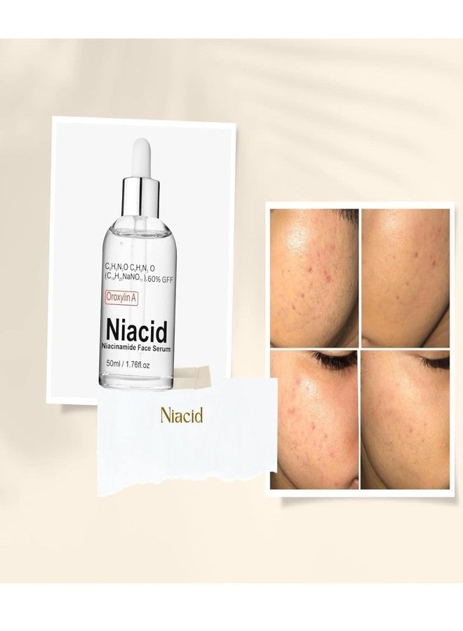 VIVAGLO Niacid Niacinamide Face Serum 5% for Oily Dry Combination Skin Brightening Open Pores Tightening Pitted Scars & Dark Acne Marks Oil Control 50ml - Image 3