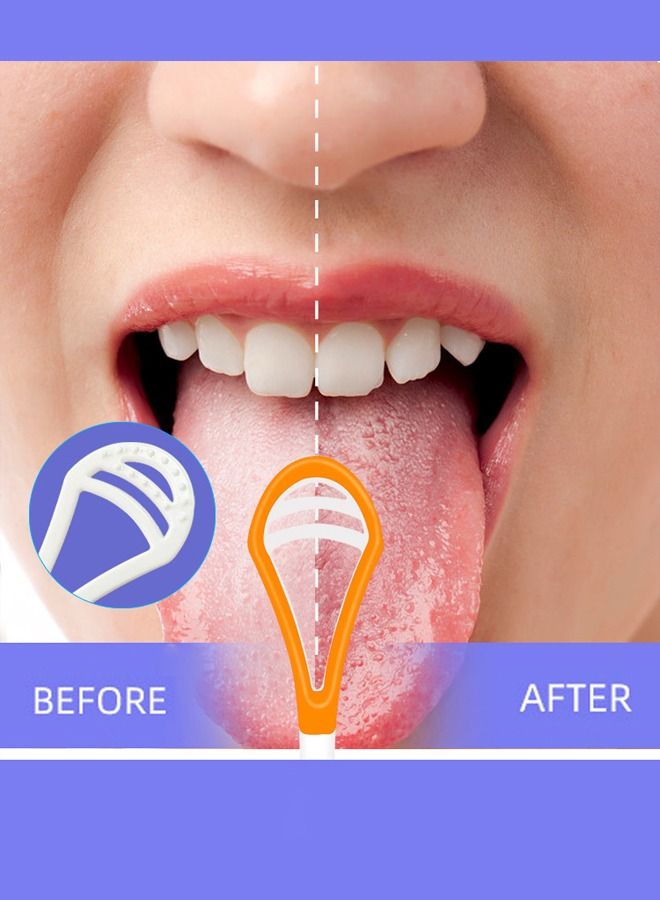 2PCS Tongue Scraper Cleaner, Oral Scrapers, Premium Sweeper Sets, Bad Breath Cure Tools, Effective Kits - Image 2