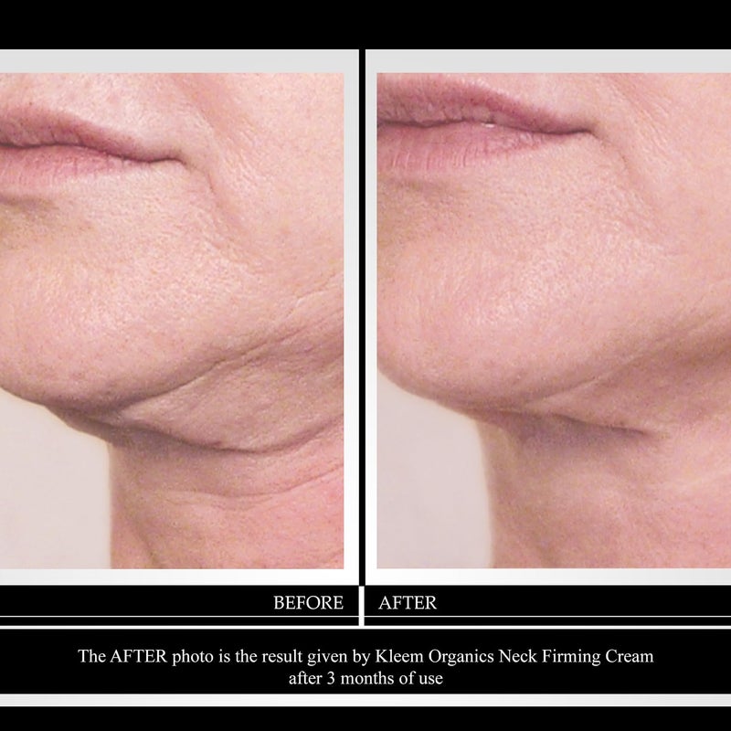 Kleem Organics Kleem Neck Firming Cream | Retinol Moisturizer for Face & Décolleté | Anti Aging Cream for Women | Smooth Fine Lines, Wrinkles & Crepey Skin | Hydrating Collagen & Peptides | Made in USA | 1.7 oz - Image 2