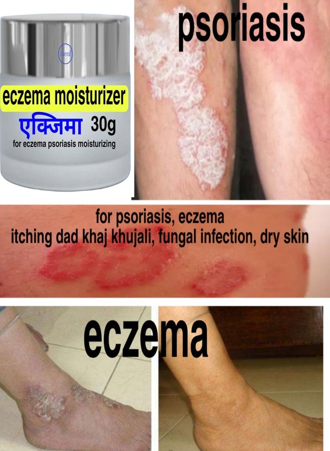 samta Eczema moisturizer - Image 2