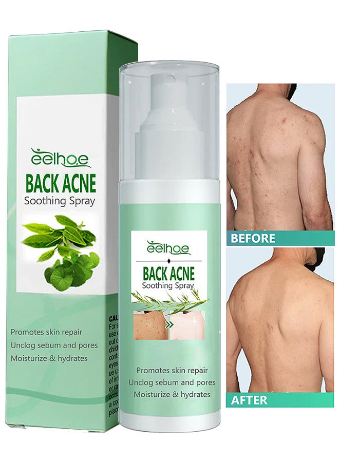 EELHOE 120ML Back Acne Treatment Soothing Spay, Back Acne Spray, Niacinamide Spray, Body Acne Treatment with Herbal Formula, Tea Tree Oil Spray, Body Acne Treatment Spray For Teens, Gentle On Skin  - Image 1
