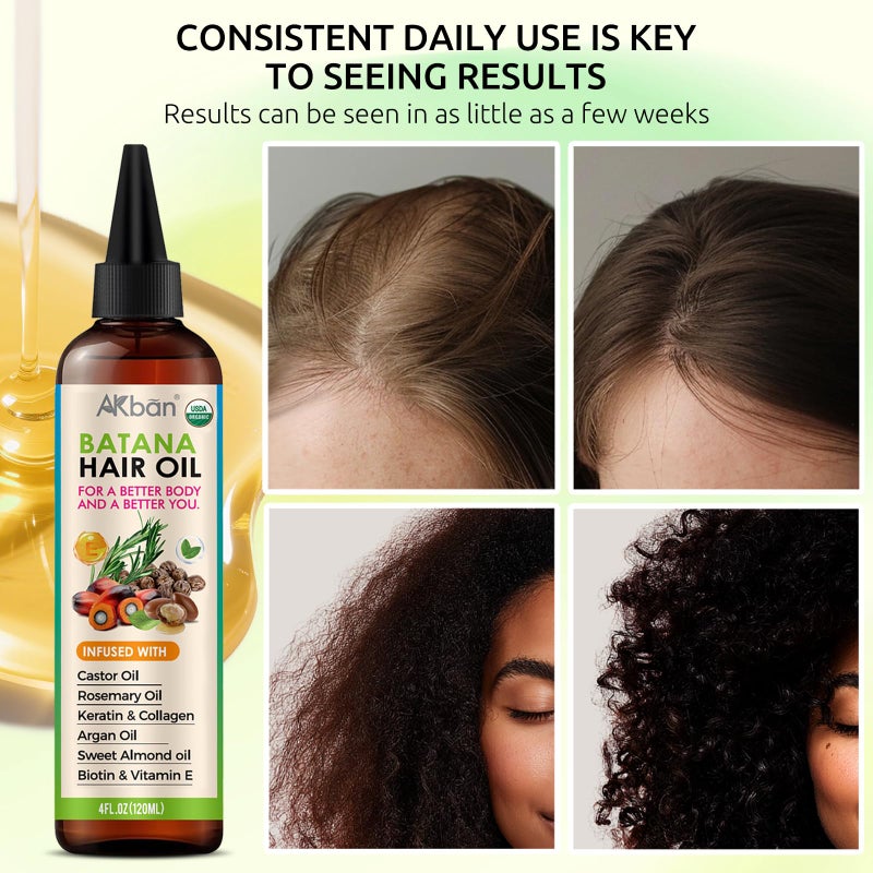 AKBAN Hair Growth Oil with 100% Pure Batana, Castor, Rosemary & Pumpkin Seed Oils â€“ Infused with Biotin, Keratin & Vitamin E â€“ Strengthening & Thickening Treatment for Healthy Hair â€“ 4 FL OZ - Image 2
