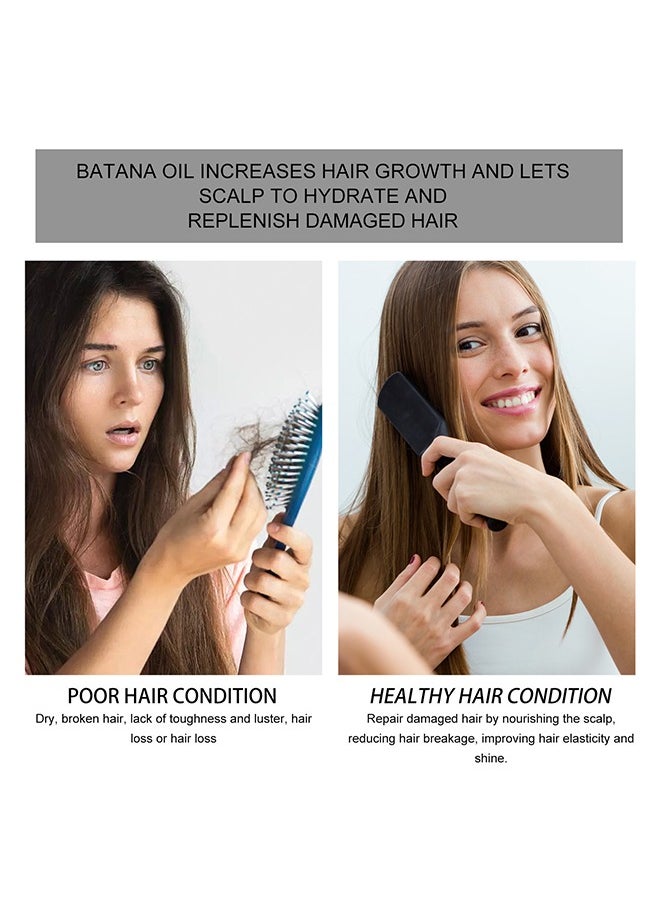 West&Month Batana Oil for Hair Growth and Repair -100% Pure, Unrefined Oil from Honduran Rainforests Prevent Hair Loss and Enhances Hair Thickness in Men & Women 100g  - Image 3