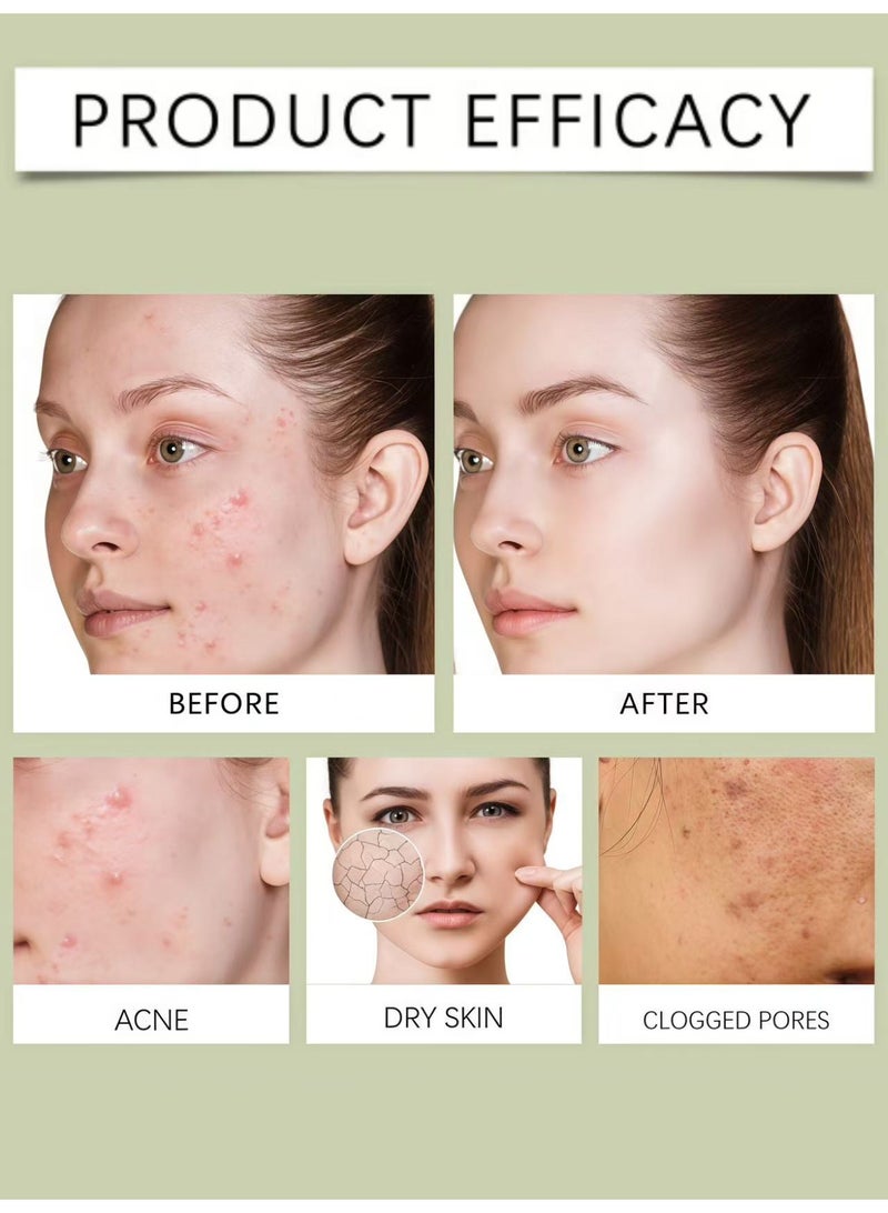 دي لا كروز مرهم علاج حب الشباب De La Cruz مع 10 ٪ من الكبريت (2 عبوات) - Image 2