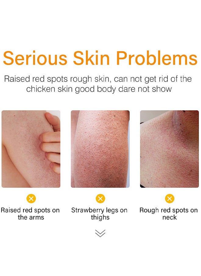 MOOYAM Strawberry Legs Treatment For Women Rough Bumpy Body Cream Lotion For Dry Skin Strawberry Skin Remover Keratosis Pilaris Treatment Moisturizing Cream Body Moisturizer For Spots Brightening Dry  - Image 4