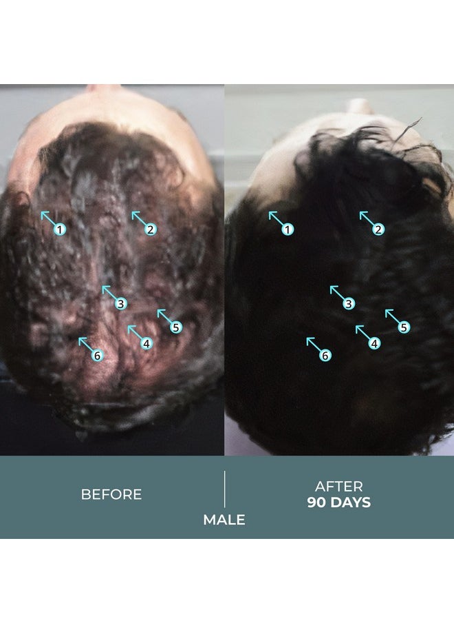 DS LABORATORIES DS Laboratories Spectral.F7 Hair Serum - Regrowth Treatment With Astressin-B & Copper Peptides for Hair Growth, Thickening, and Loss Prevention for Men & Women  - Image 3