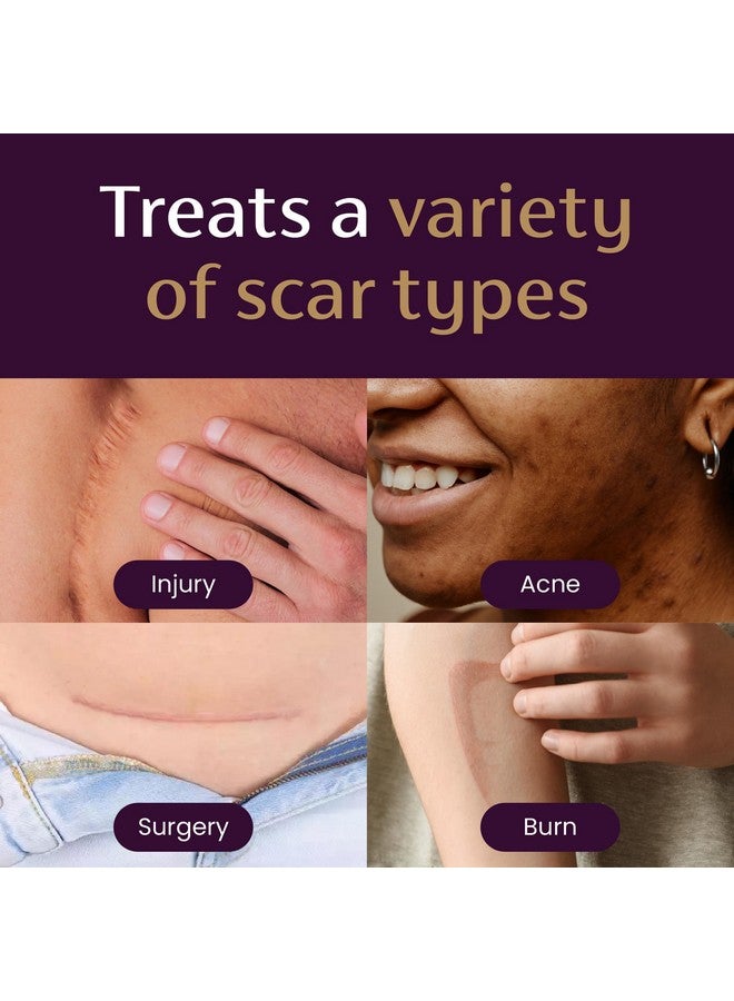 Mederma Advanced Scar Gel, Treats Old And New Scars, Reduces The Appearance Of Scars From Acne, Stitches, Burns And More, 50 Grams - Image 4