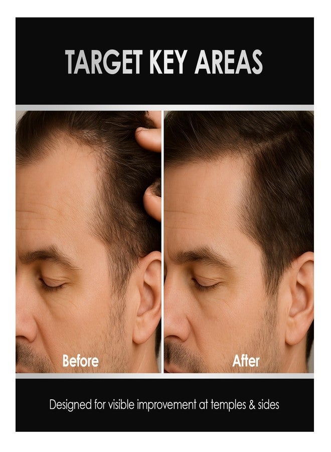 ThickTails Men’s Hair Growth Serum for Thinning Hair | Leave-In Root & Scalp Serum with Caffeine, Biotin & Saw Palmetto | Lightweight Vegan Hair Thickening Treatment, 1.7 fl oz - Image 2