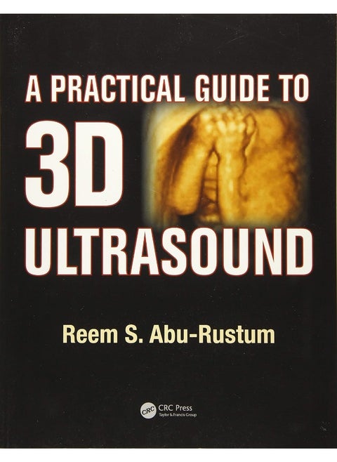 A Practical Guide to 3D Ultrasound