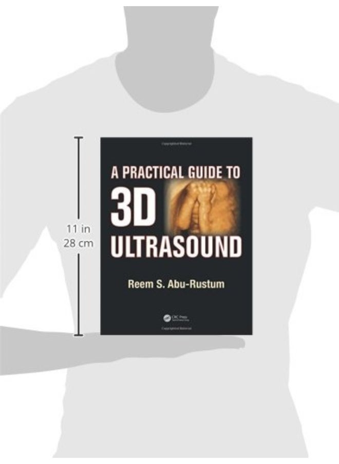 null - A Practical Guide to 3D Ultrasound - Image 1