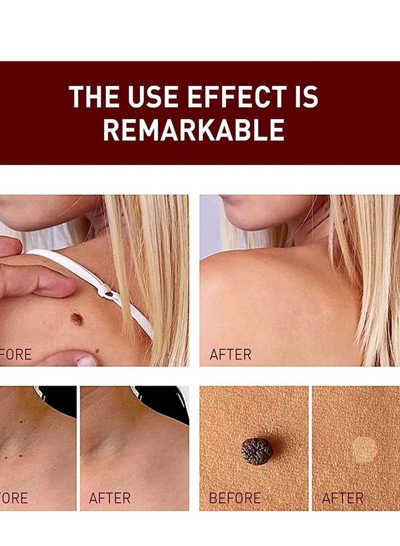 Excefore 3 Pcs Wipe Off Tags and Mole Remover, Skin Tag Remover Mole Remover, Easy to Remove, for All Body Parts, Face Armpit Flesh Neck - Image 4