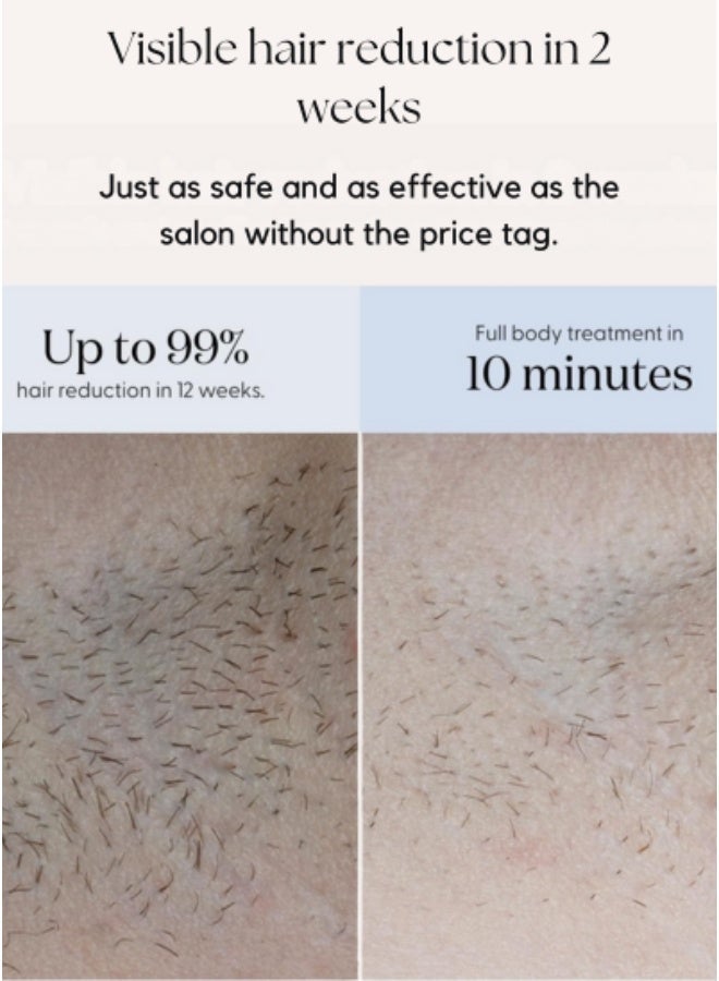 SmoothSkin Pure Fit IPL Hair Removal Device for Women & Men – Ultrafast, Painless At-Home Hair Removal for Body & Face, Clinically Tested, FDA Cleared - Image 4