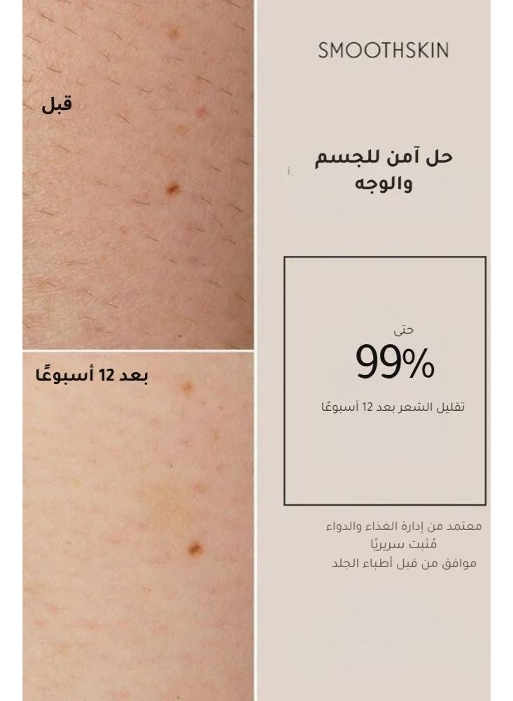 سموث سكن  جهاز سموذ سكين بيور فيت لإزالة الشعر بتقنية IPL للنساء والرجال – إزالة شعر منزلية فائقة السرعة وبدون ألم للجسم والوجه، مختبر سريريًا ومعتمد من FDA - Image 5