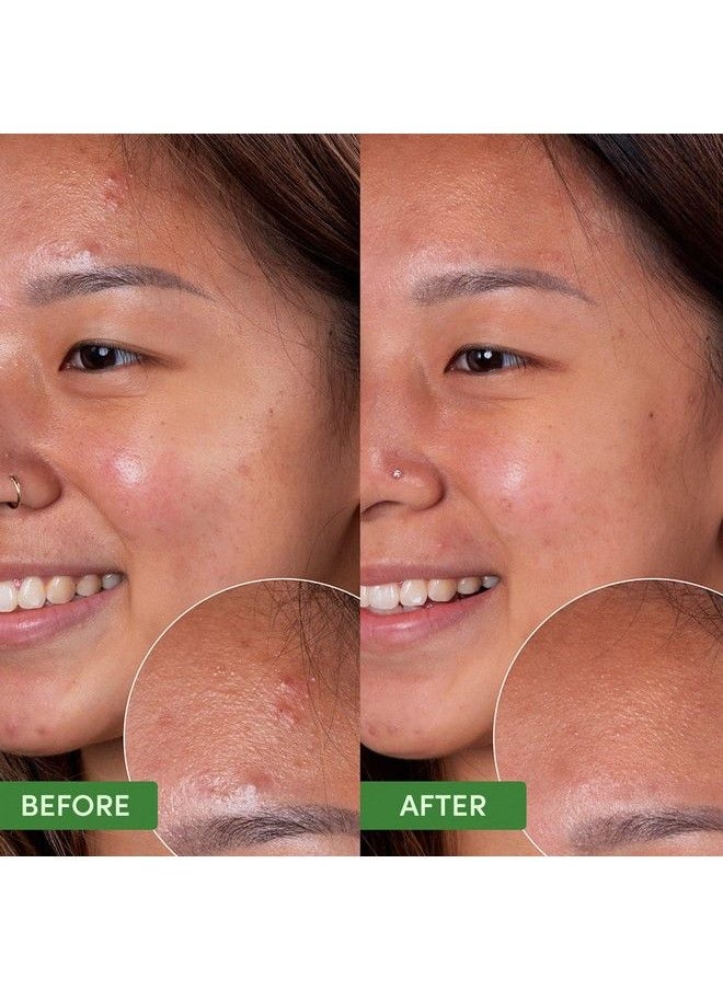 Sand & Sky Oil Control Clearing Cleanser  - Image 5